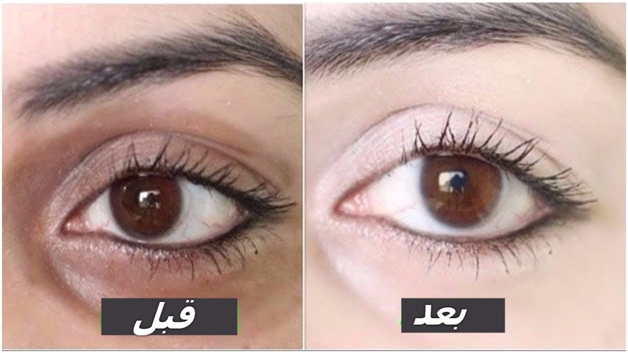 “وشك هيرجع ينور من تاني” وصفات سحرية بمواد طبيعية للتخلص من الهالات السوداء حول العينين